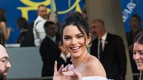 Kendall Jenner es acusada de fuga luego que su perro mordiera a una niña