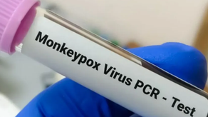 El paciente con viruela del mono tiene 33 años.