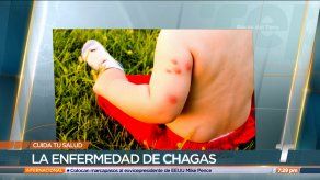 Cuida tu salud: Enfermedad de Chagas