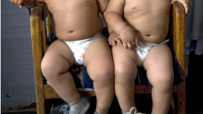 Tres de cada 10 niños y adolescentes en Panamá son obesos