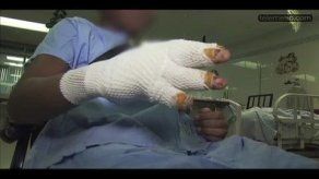 Tres casos de niños quemados por bombitas en el HDN hasta la fecha