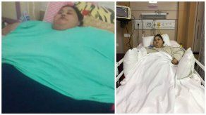 La mujer más obesa del mundo pierde 250 kg tras operación en India