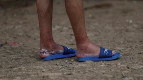 Chile, donde viven casi 1,5 millones de migrantes, puso en práctica en abril una reformada ley que exige a los extranjeros que desean vivir en el país obtener una visa en los consulados de sus países de origen para luego tramitar localmente.