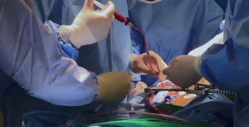 ¡Excelente noticia! CSS realiza más de 800 intervenciones cardiovasculares en solo dos meses