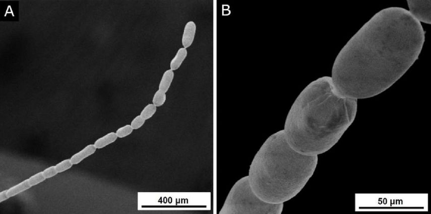 Bacteria thiomargarita magnifica.