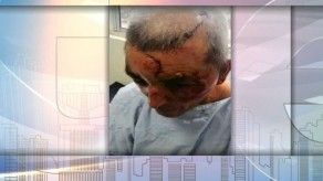 Delincuentes agreden a adulto mayor en Chiriquí, le robaron más de B/.5 mil y su auto