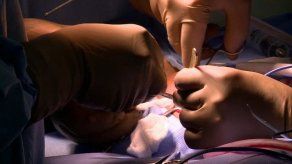 La niña india que padece hidrocefalia fue operada con éxito