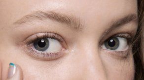 5 formas para eliminar las ojeras