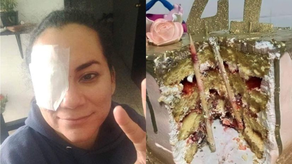 Hunden rostro de una mujer en pastel y termina con un palo en el ojo