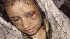 Joven afgana torturada recibirá atención médica en la India