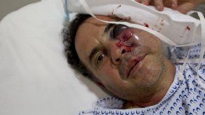 Golpean 4 periodistas en marcha en capital México