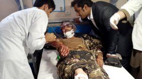 Mueren 19 personas en un atentado suicida en Afganistán