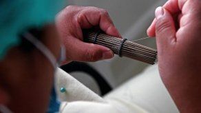 Tejedoras aimaras bolivianas ayudan a salvar a niños con cardiopatías