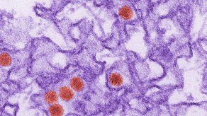 EEUU: Hombre sin síntomas contagia zika por contacto sexual