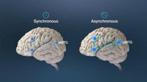 El descubrimiento de la causa de las alucinaciones menores podría ser un buen marcador para estudiar el progreso del Parkisnon y realizar un diagnóstico precoz de la enfermedad.