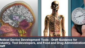 Advierte FDA sobre desfibriladores de Philips