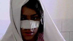 Talibanes desmienten protección de afgano que cortó la nariz de su mujer
