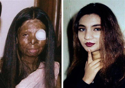 Muchas mujeres en Pakistán reciben horrible maltrato