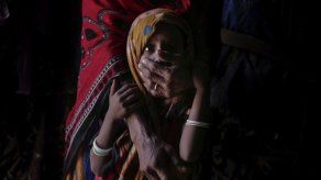 Yemen: La lucha de una madre por salvar a su bebé desnutrido