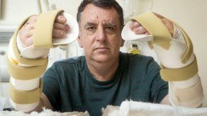 Gran Bretaña: Paciente se recupera de trasplante de manos