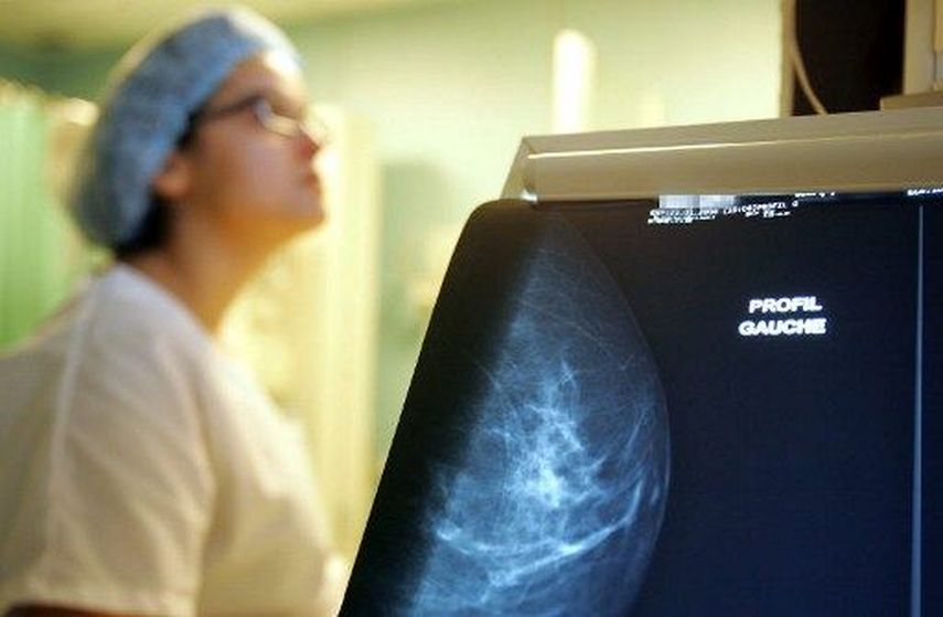 Minsa habilita citas de mamografía