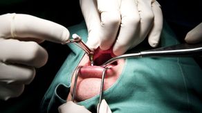 Ante Audiencia de Garantías colombiano que prestaba servicios de odontología sin permisos