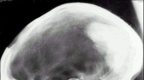 Se llena eslabón en evolución de las especies