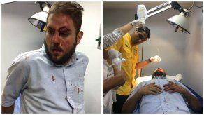 Diputado opositor venezolano resulta herido durante protesta